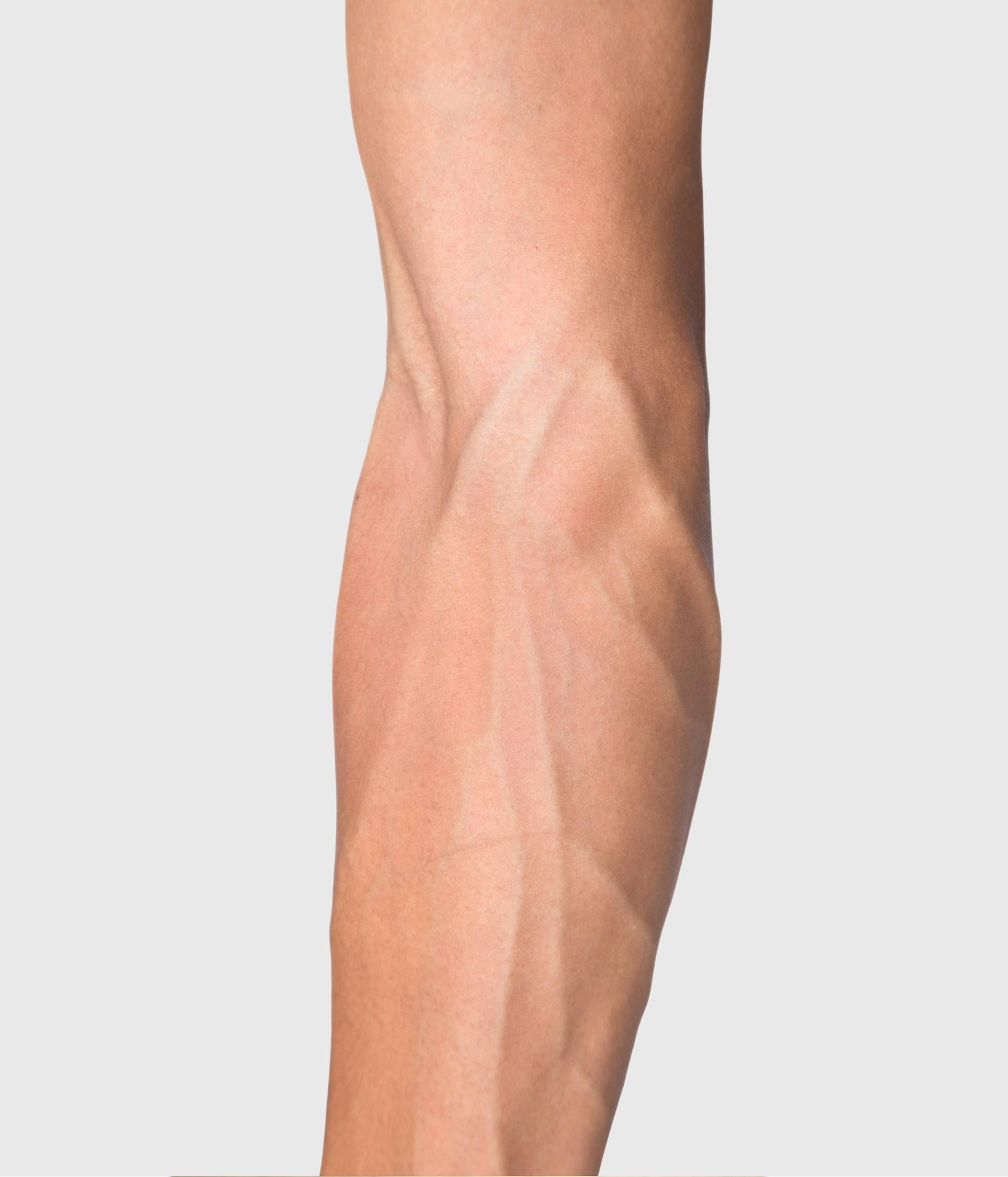 Arm Veins