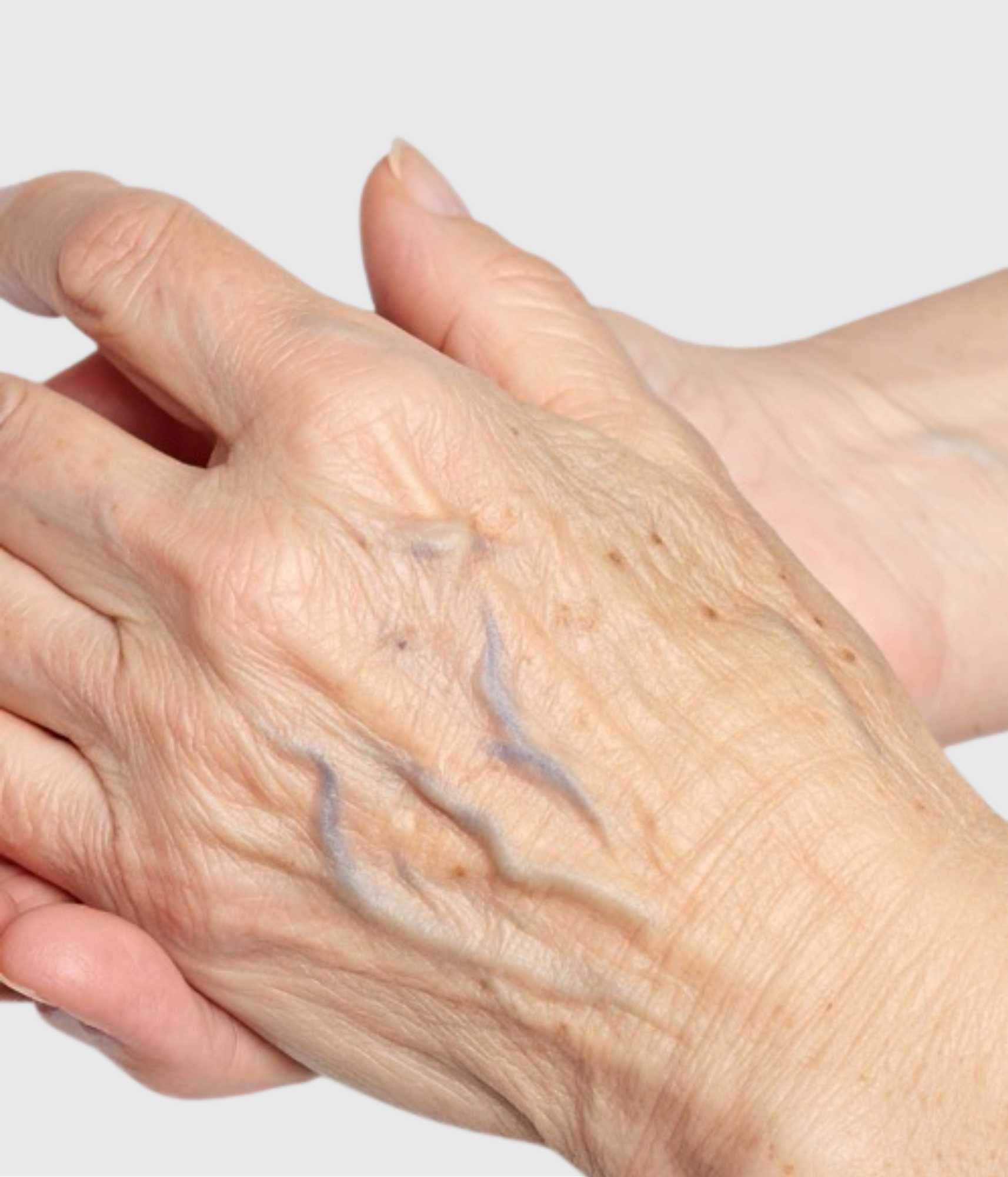 Hand Veins