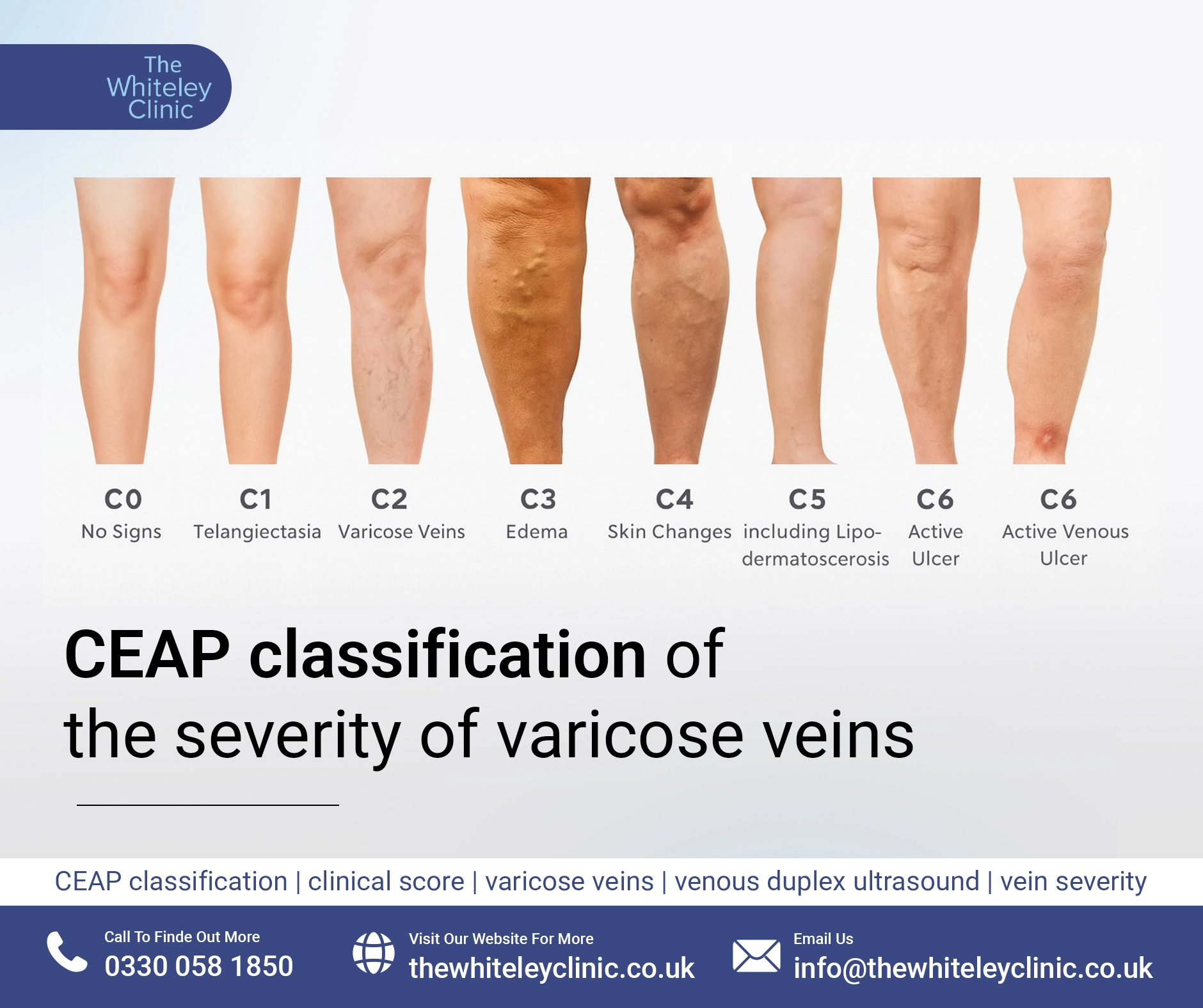 CEAP clinical score