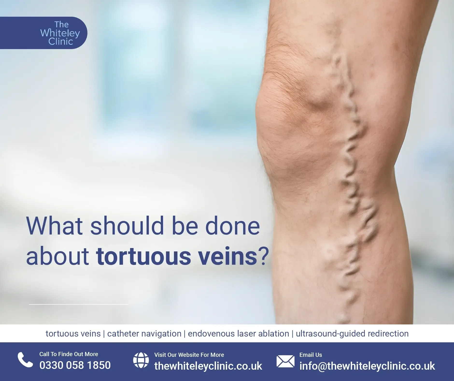 What should be done about tortuous veins?