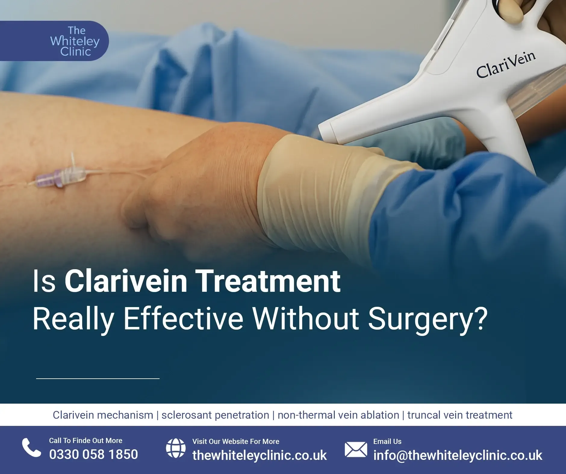 Is Clarivein Treatment Really Effective Without Surgery?